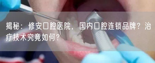 揭秘：修安口腔医院，国内口腔连锁品牌？治疗技术究竟如何？(图1)