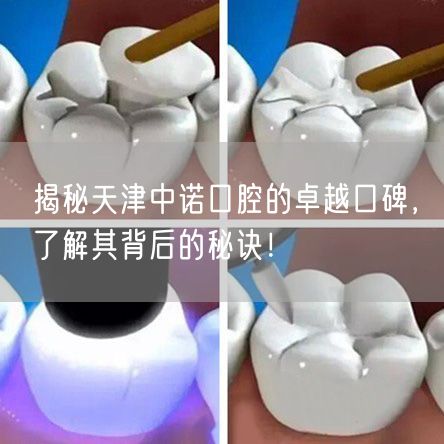 揭秘天津中诺口腔的卓越口碑，了解其背后的秘诀！(图1)