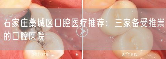 石家庄藁城区口腔医疗推荐：三家备受推崇的口腔医院
