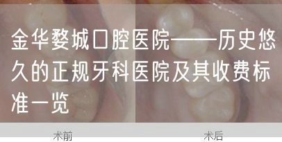 金华婺城口腔医院——历史悠久的正规牙科医院及其收费标准一览