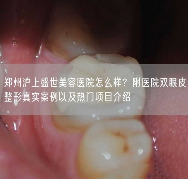 郑州沪上盛世美容医院怎么样？附医院双眼皮整形真实案例以及热门项目介绍