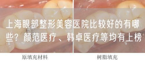 上海眼部整形美容医院比较好的有哪些？颜范医疗、韩卓医疗等均有上榜