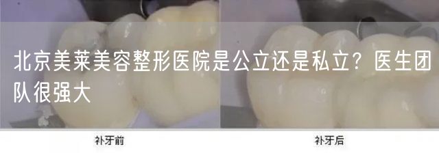 北京美莱美容整形医院是公立还是私立？医生团队很强大
