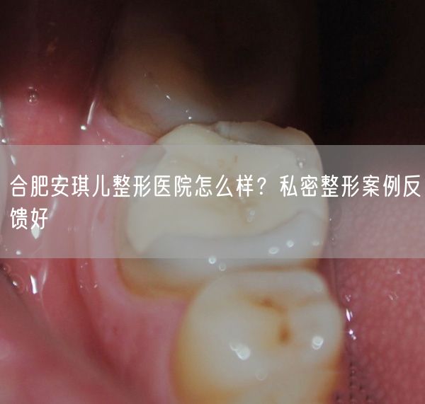 合肥安琪儿整形医院怎么样？私密整形案例反馈好