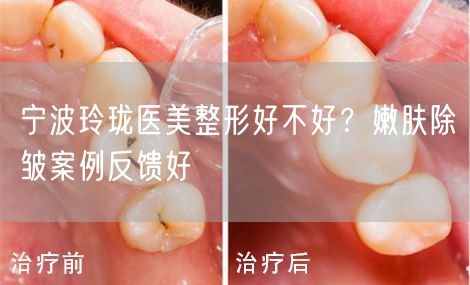 宁波玲珑医美整形好不好？嫩肤除皱案例反馈好