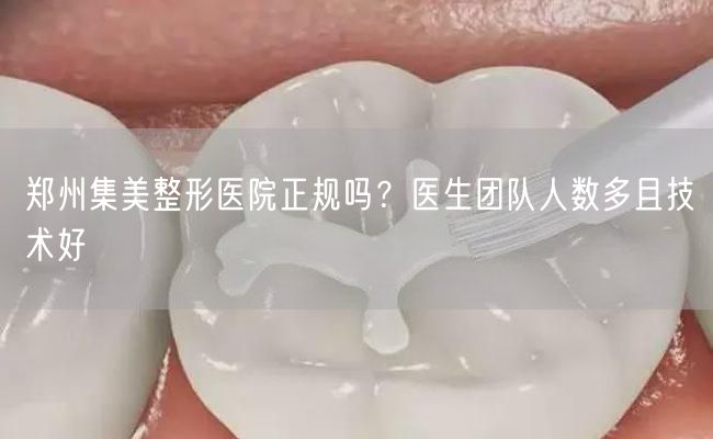 郑州集美整形医院正规吗？医生团队人数多且技术好