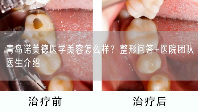 青岛诺美德医学美容怎么样？整形问答+医院团队医生介绍