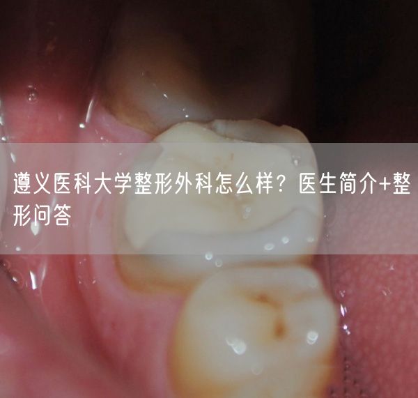 遵义医科大学整形外科怎么样？医生简介+整形问答