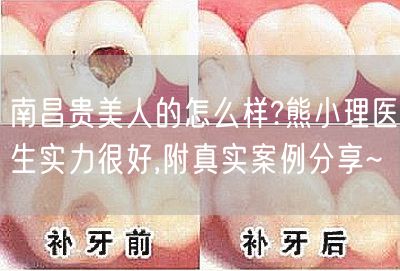 南昌贵美人的怎么样?熊小理医生实力很好,附真实案例分享~
