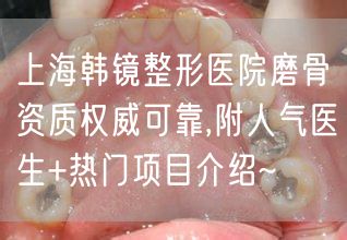 上海韩镜整形医院磨骨资质权威可靠,附人气医生+热门项目介绍~