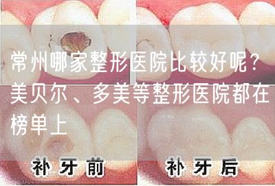 常州哪家整形医院比较好呢？美贝尔、多美等整形医院都在榜单上