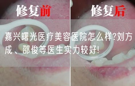 嘉兴曙光医疗美容医院怎么样?刘方成、邵俊等医生实力较好!