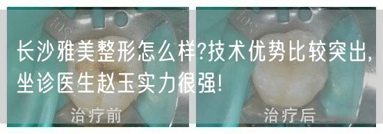 长沙雅美整形怎么样?技术优势比较突出,坐诊医生赵玉实力很强!