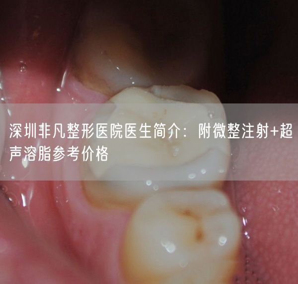 深圳非凡整形医院医生简介：附微整注射+超声溶脂参考价格