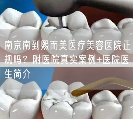 南京南到熙而美医疗美容医院正规吗？附医院真实案例+医院医生简介