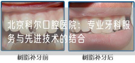 北京科尔口腔医院：专业牙科服务与先进技术的结合