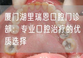 厦门湖里瑞恩口腔门诊部：专业口腔治疗的优质选择(图1)