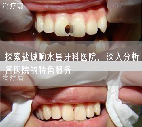 探索盐城响水县牙科医院，深入分析各医院的特色服务