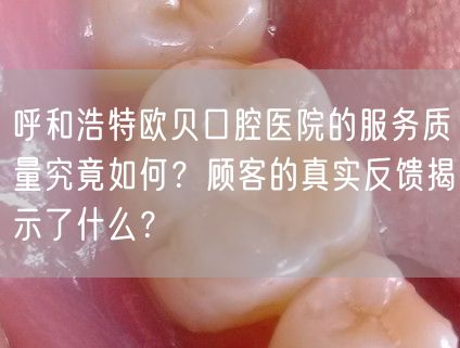 呼和浩特欧贝口腔医院的服务质量究竟如何？顾客的真实反馈揭示了什么？