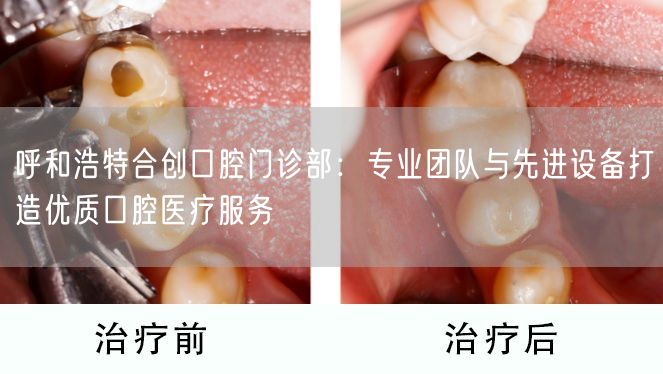 呼和浩特合创口腔门诊部：专业团队与先进设备打造优质口腔医疗服务