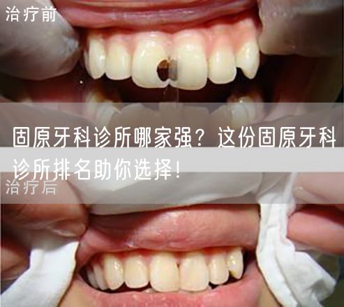 固原牙科诊所哪家强？这份固原牙科诊所排名助你选择！(图1)