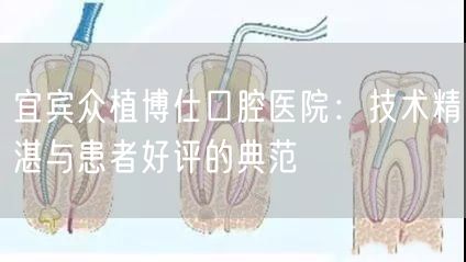宜宾众植博仕口腔医院：技术精湛与患者好评的典范(图1)