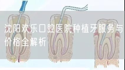 沈阳欢乐口腔医院种植牙服务与价格全解析