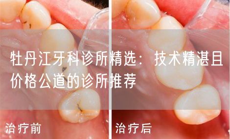牡丹江牙科诊所精选：技术精湛且价格公道的诊所推荐