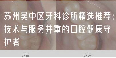 苏州吴中区牙科诊所精选推荐：技术与服务并重的口腔健康守护者