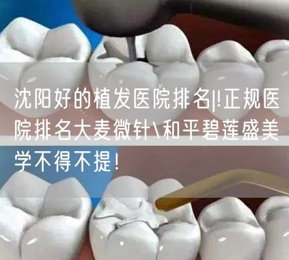 沈阳好的植发医院排名|!正规医院排名大麦微针\和平碧莲盛美学不得不提！