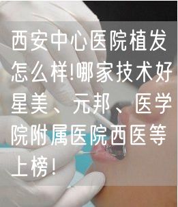 西安中心医院植发怎么样!哪家技术好星美、元邦、医学院附属医院西医等上榜！