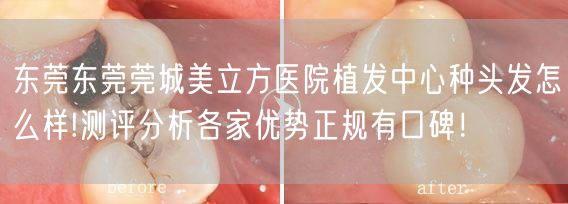 东莞东莞莞城美立方医院植发中心种头发怎么样!测评分析各家优势正规有口碑！