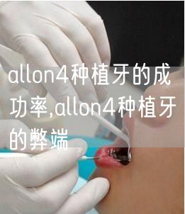 allon4种植牙的成功率,allon4种植牙的弊端