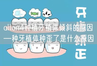 allon4种植牙植体倾斜的原因—种牙植体种歪了是什么原因