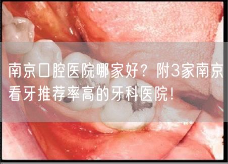 南京口腔医院哪家好？附3家南京看牙推荐率高的牙科医院！