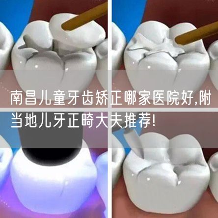 南昌儿童牙齿矫正哪家医院好,附当地儿牙正畸大夫推荐!