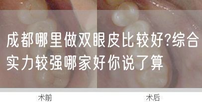 成都哪里做双眼皮比较好?综合实力较强哪家好你说了算