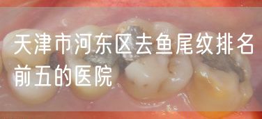 天津市河东区去鱼尾纹排名前五的医院