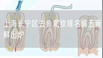 上海长宁区去鱼尾纹排名前五新鲜出炉
