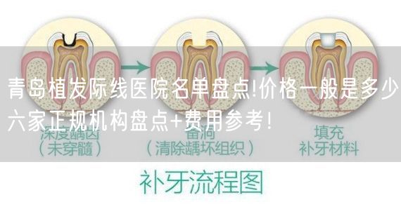 青岛植发际线医院名单盘点!价格一般是多少六家正规机构盘点+费用参考！