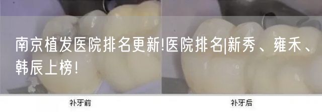 南京植发医院排名更新!医院排名|新秀、雍禾、韩辰上榜！