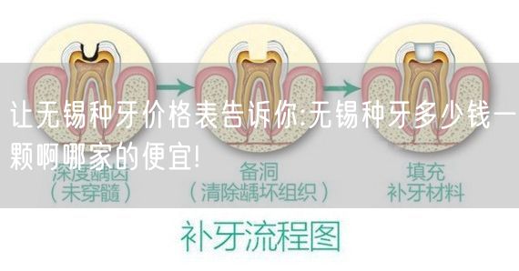 让无锡种牙价格表告诉你:无锡种牙多少钱一颗啊哪家的便宜!