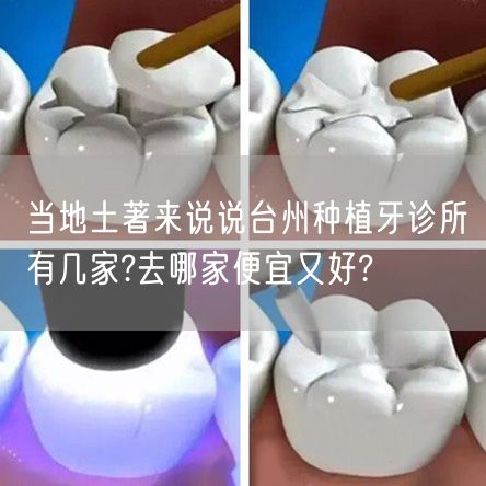 当地土著来说说台州种植牙诊所有几家?去哪家便宜又好?