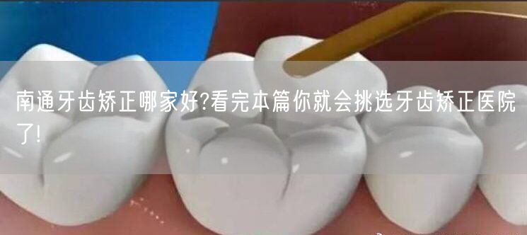 南通牙齿矫正哪家好?看完本篇你就会挑选牙齿矫正医院了!