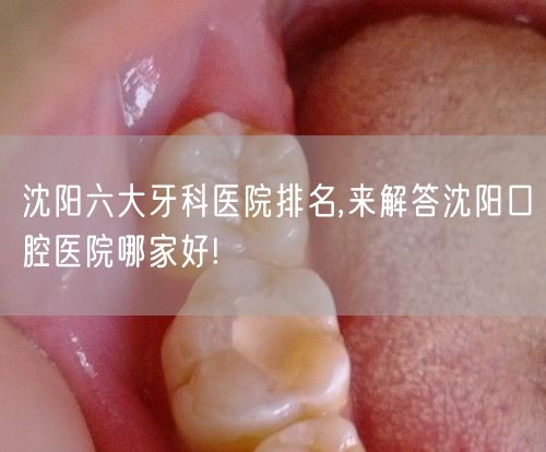 沈阳六大牙科医院排名,来解答沈阳口腔医院哪家好!