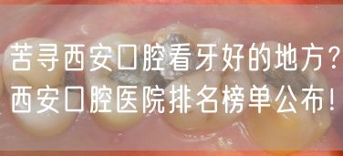 苦寻西安口腔看牙好的地方？西安口腔医院排名榜单公布！