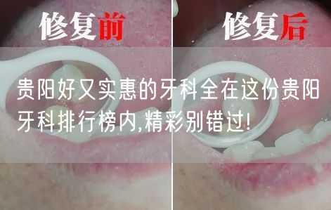 贵阳好又实惠的牙科全在这份贵阳牙科排行榜内,精彩别错过!