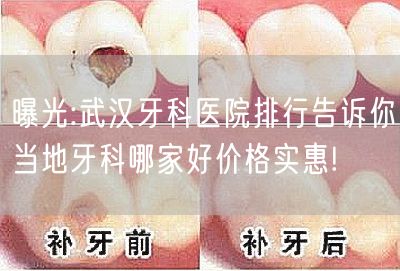 曝光:武汉牙科医院排行告诉你当地牙科哪家好价格实惠!