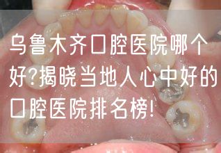 乌鲁木齐口腔医院哪个好?揭晓当地人心中好的口腔医院排名榜!