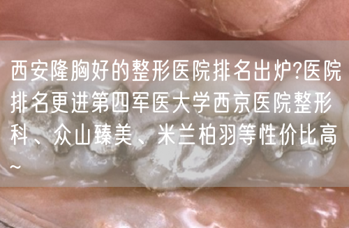 西安隆胸好的整形医院排名出炉?医院排名更进第四军医大学西京医院整形科、众山臻美、米兰柏羽等性价比高~